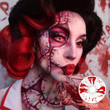 Bloodstained Sclera Lenses