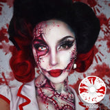 Bloodstained Sclera Lenses