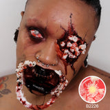 Patient Zero Sclera Lenses