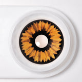 Radioactive Sclera Lenses