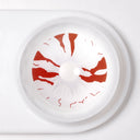 Bloodstained Sclera Lenses