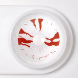 Bloodstained Sclera Lenses
