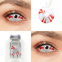 Bloodstained Sclera Lenses