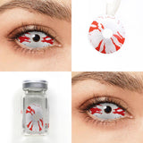 Bloodstained Sclera Lenses