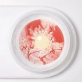 Patient Zero Sclera Lenses