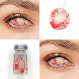 Patient Zero Sclera Lenses