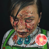Patient Zero Sclera Lenses