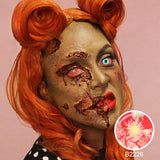 Patient Zero Sclera Lenses