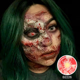 Patient Zero Sclera Lenses