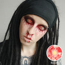 Patient Zero Sclera Lenses