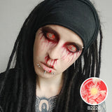 Patient Zero Sclera Lenses