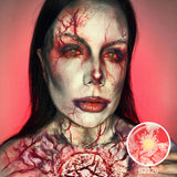 Patient Zero Sclera Lenses
