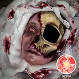 Patient Zero Sclera Lenses