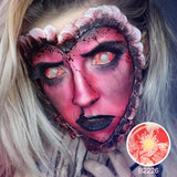 Patient Zero Sclera Lenses