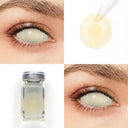 Blind Yellowish Sclera Lenses