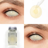 Blind Yellowish Sclera Lenses