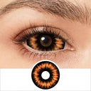 Radioactive Sclera Lenses