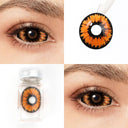 Radioactive Sclera Lenses