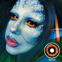 Radioactive Sclera Lenses