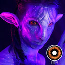 Radioactive Sclera Lenses