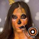 Radioactive Sclera Lenses