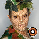 Radioactive Sclera Lenses