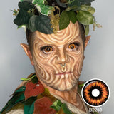 Radioactive Sclera Lenses
