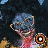 Radioactive Sclera Lenses