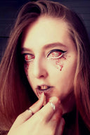 Patient Zero Sclera Lenses