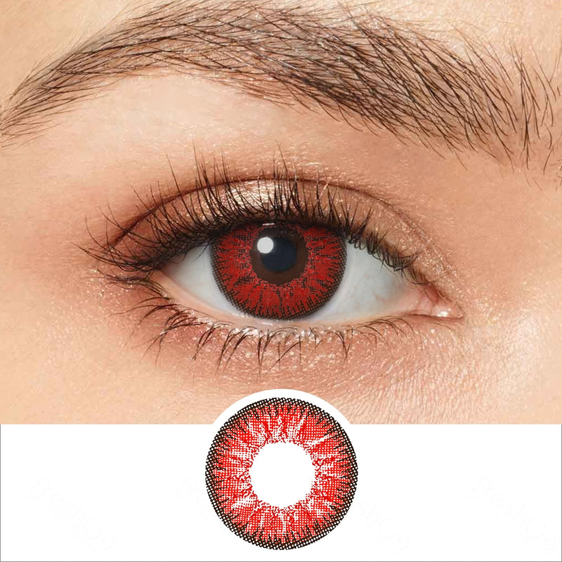 22F, Red ring around iris, never worn contacts : r/eyetriage